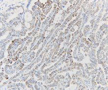 Charger l'image dans la galerie, BRAF (DA007)