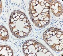 Charger l'image dans la galerie, CK20 (DA044)