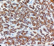 Charger l'image dans la galerie, CK 8 & 18 (DA047)