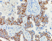 Charger l'image dans la galerie, CK (bas poids moléculaire) (DA038)