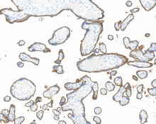 Charger l'image dans la galerie, PLAP (DA199)