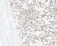 Charger l'image dans la galerie, SALL4 (DA106)