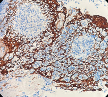 Charger l'image dans la galerie, CK5&amp;6 (DA045)
