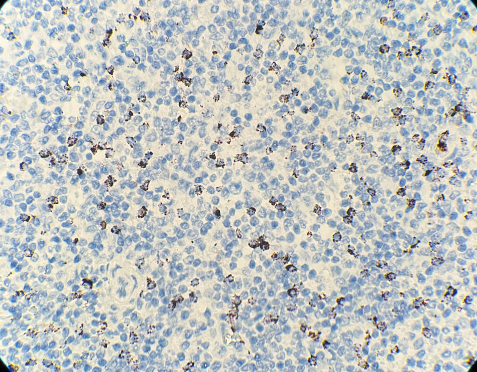 TIA-1 (DA112)