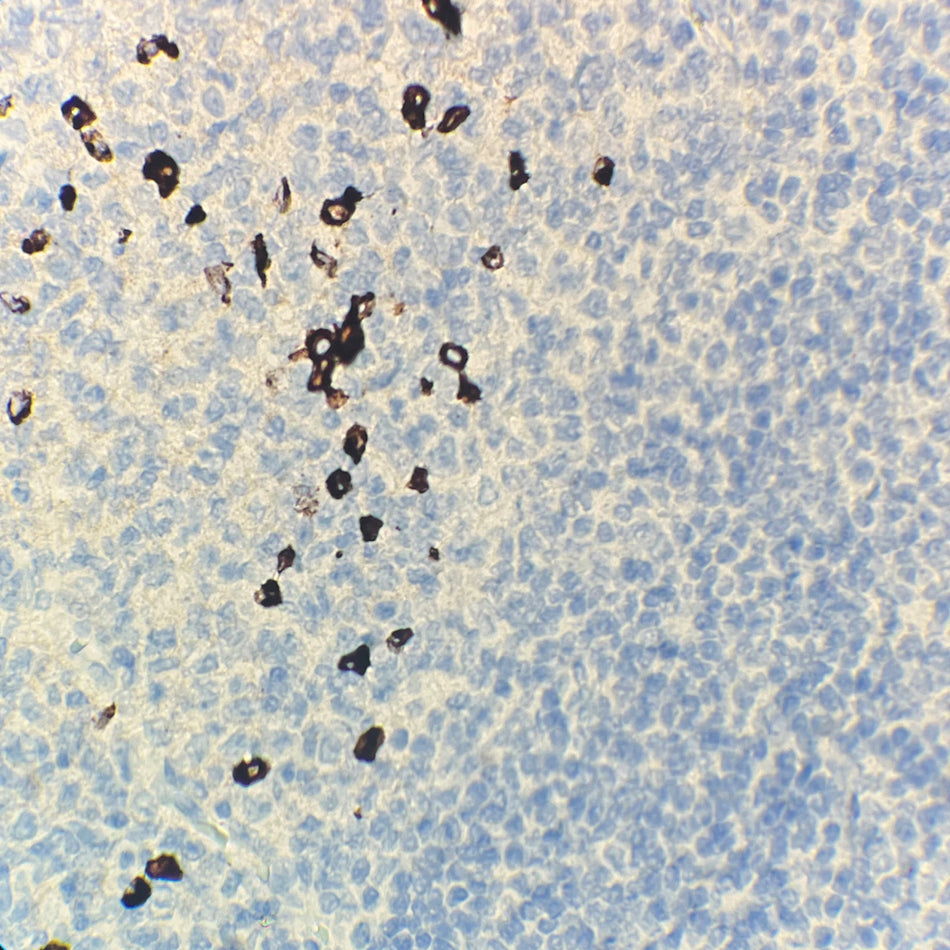 IgG4 (DA072)