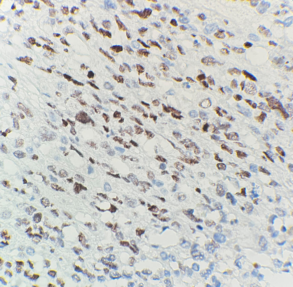Myo D1