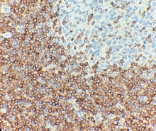 Charger l'image dans la galerie, Bcl-2 (DA004)
