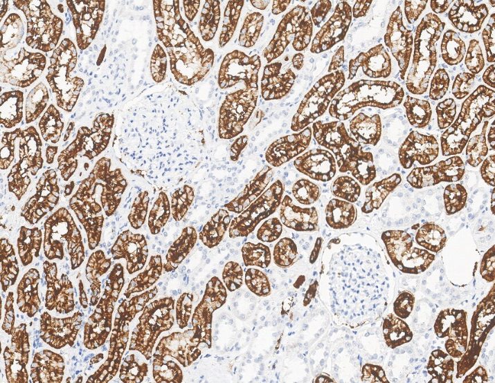 CD15 (DA014)