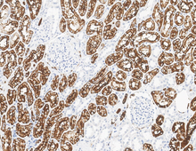 Charger l'image dans la galerie, CD15 (DA014)
