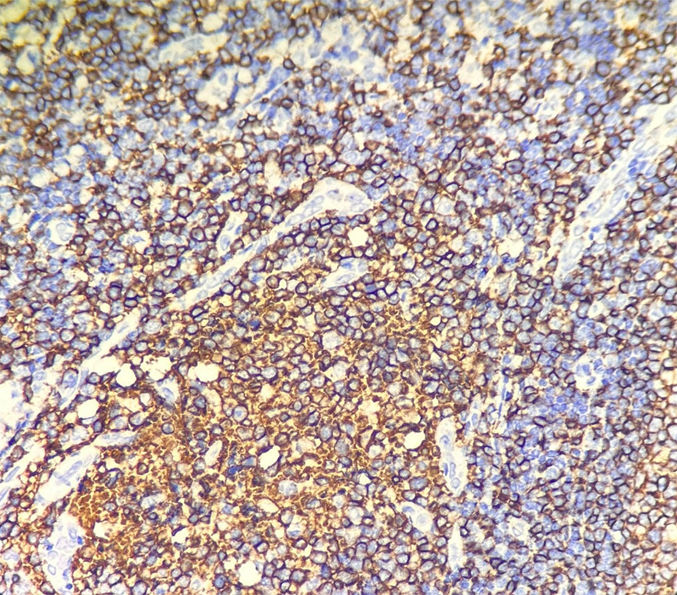 CD20 (DA144)