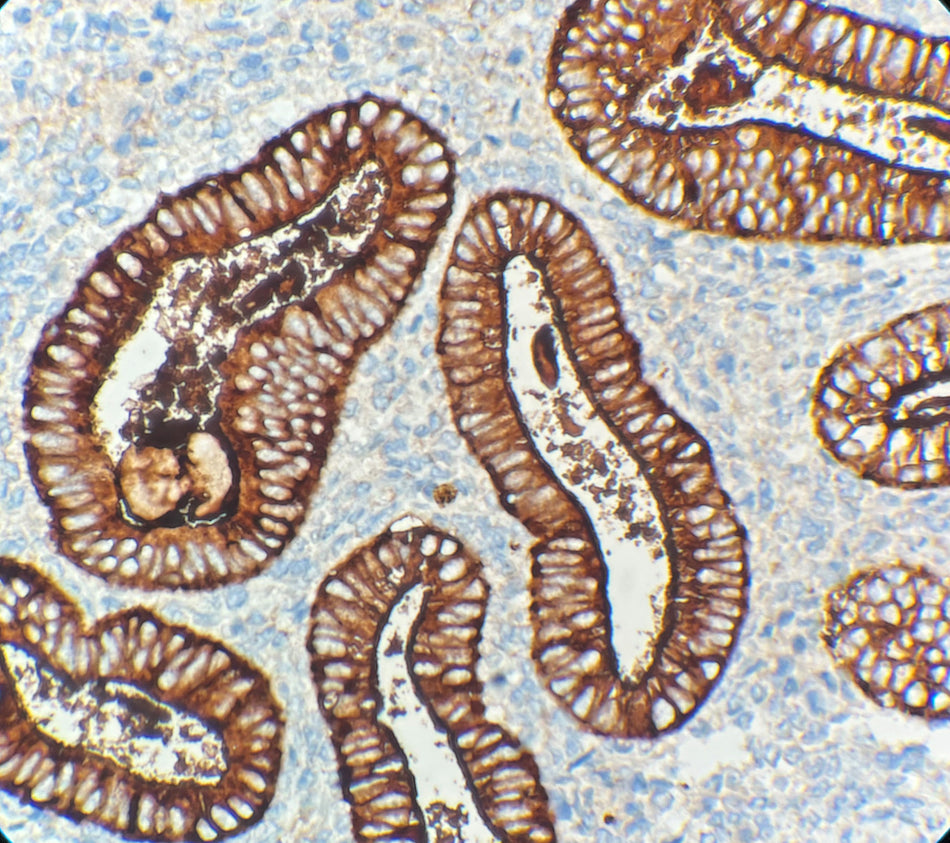 CA 125 (DA121)