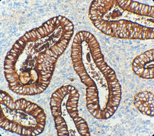 Charger l'image dans la galerie, CA 125 (DA121)
