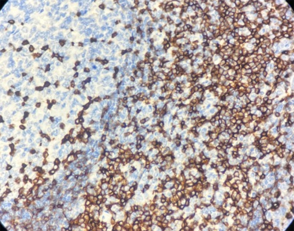 CD5 (DA029)