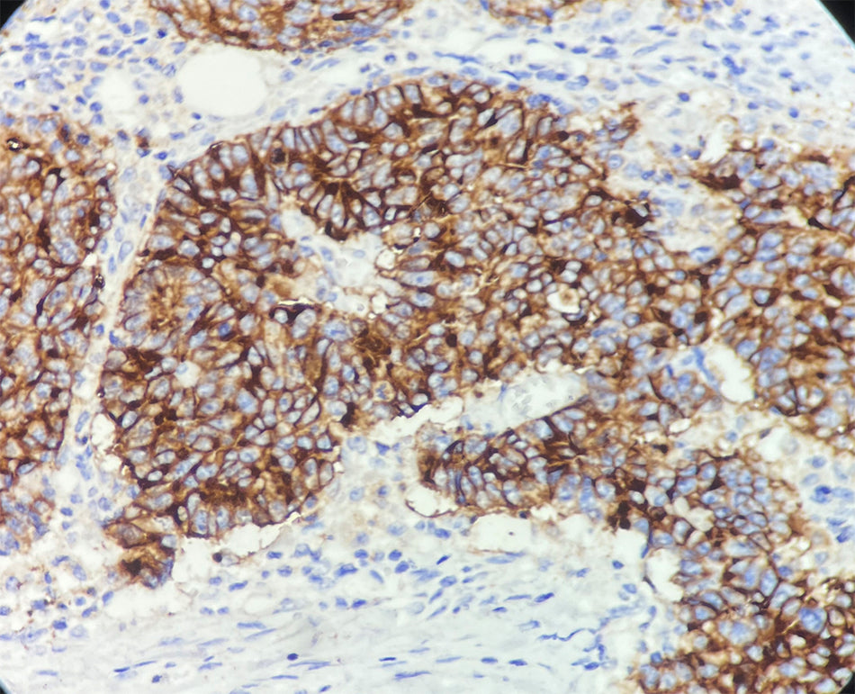 CA 19-9 (DA122)