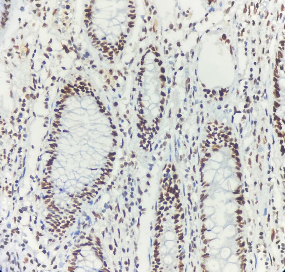 MSH6 (DA084)