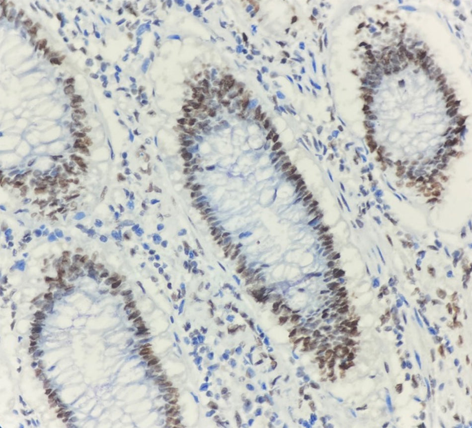 MLH1 (DA081)