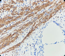 Charger l'image dans la galerie, CALD1 (DA009)
