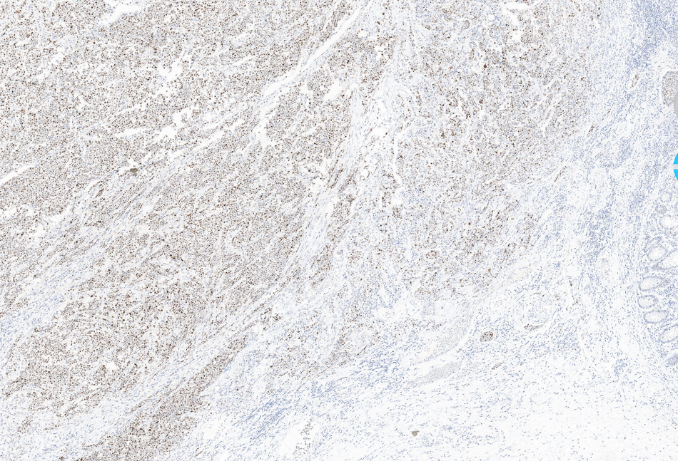 p53 (DA095)