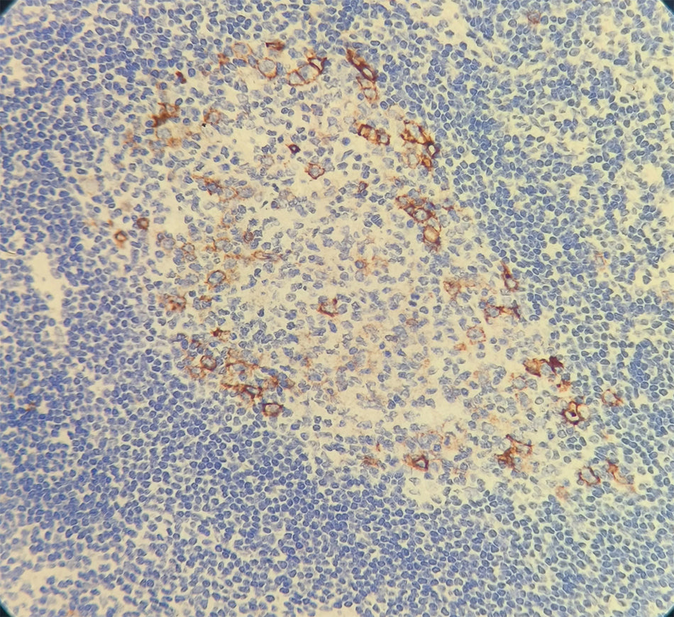 CD30 (DA020)
