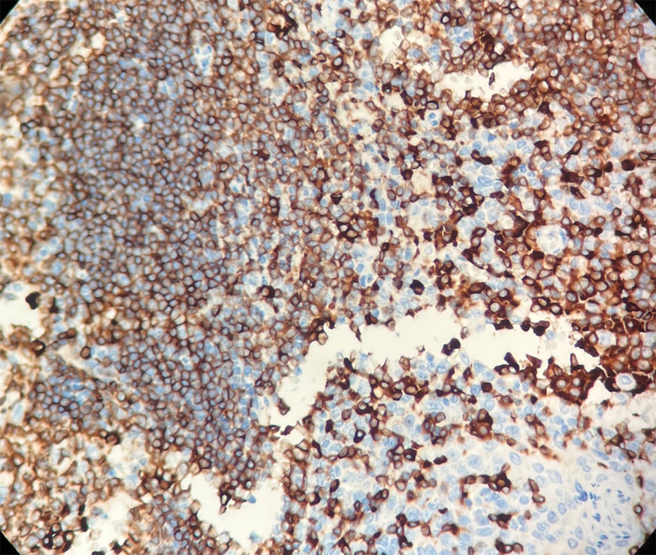 CD79a (DA031)