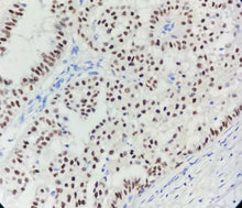 Charger l'image dans la galerie, RE
