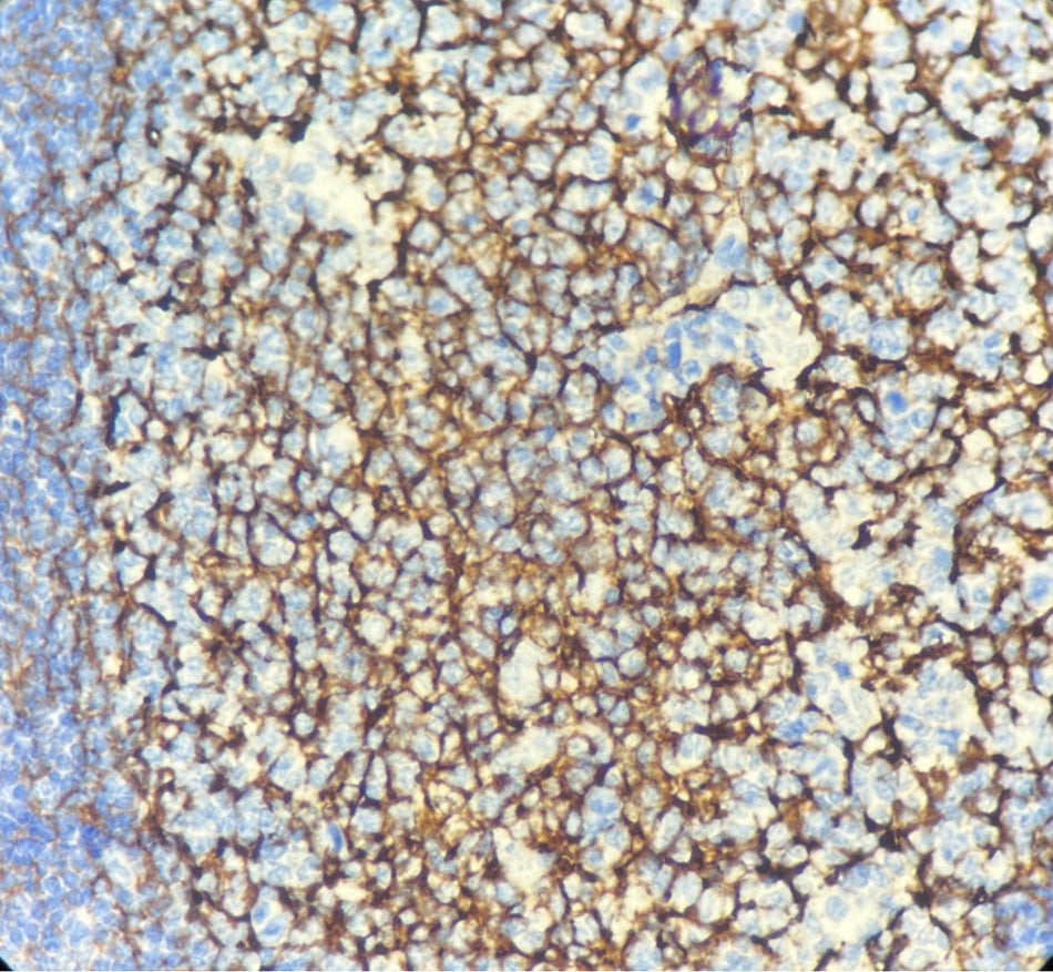 CD21 (DA017)