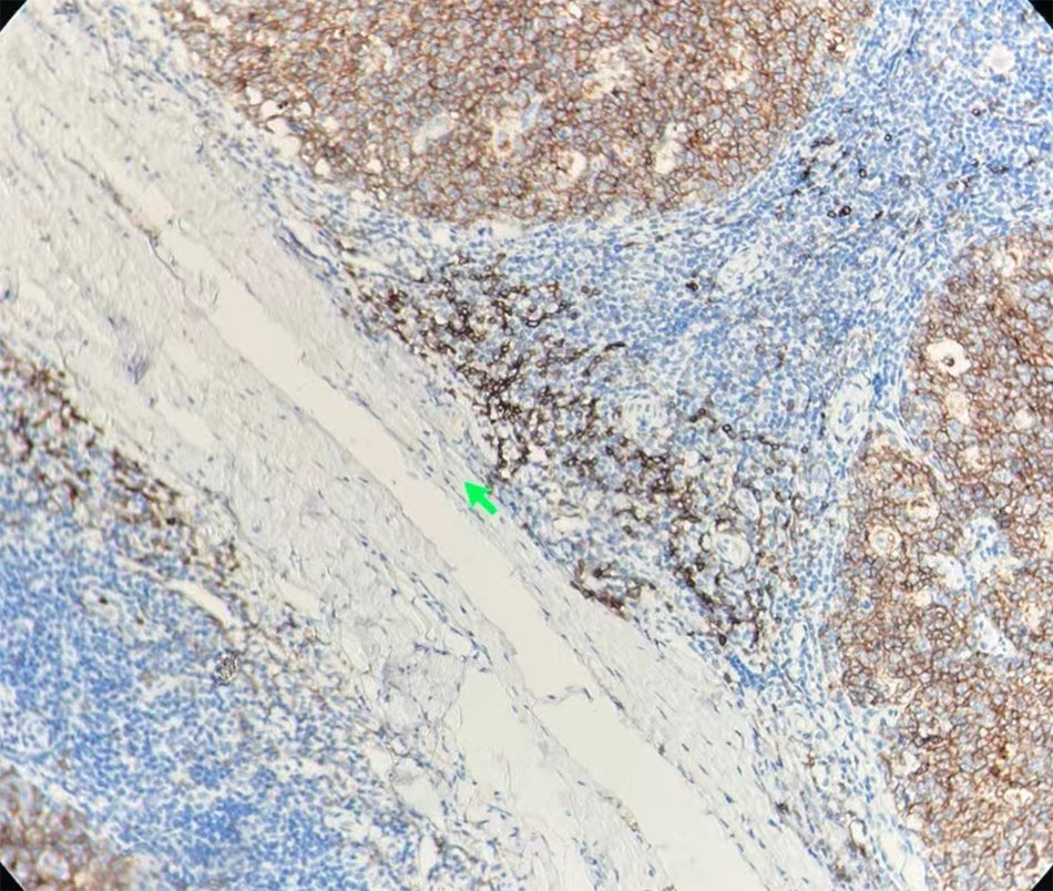 CD10 (DA012)