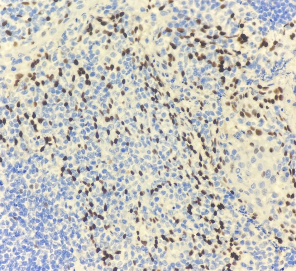 p63 (DA097)