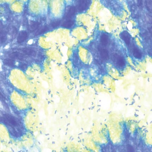 Kit Jaune Alcian Bleu Toluidine
