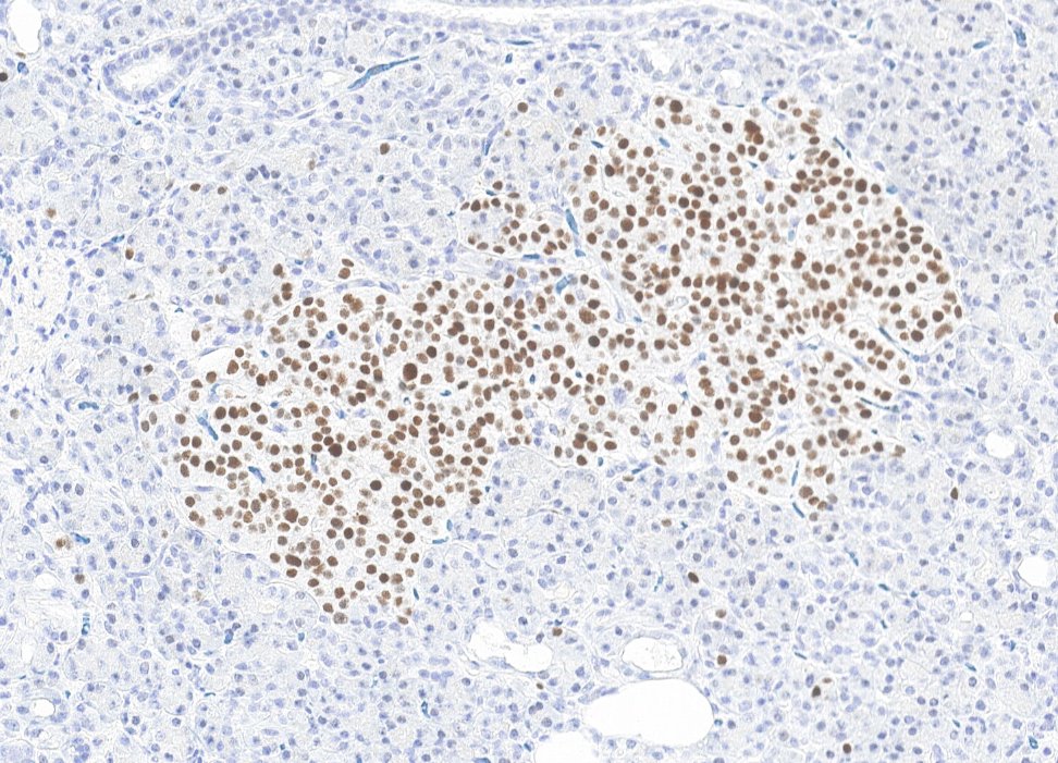 Marquage immunohistochimique anti-INSM1 — Dartmon