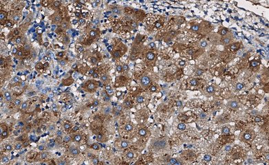 Marquage immunohistochimique anti-AAT — Dartmon