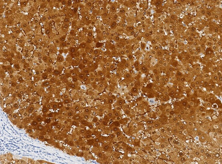 Marquage immunohistochimique anti-Arg — Dartmon