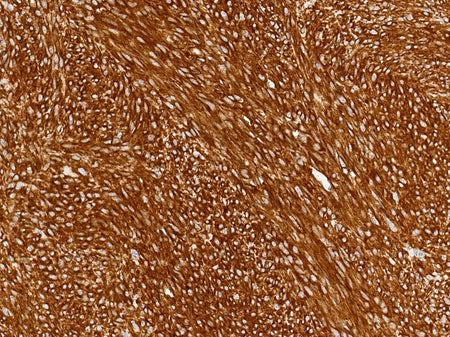 Marquage immunohistochimique anti-c-KIT/CD117 — Dartmon