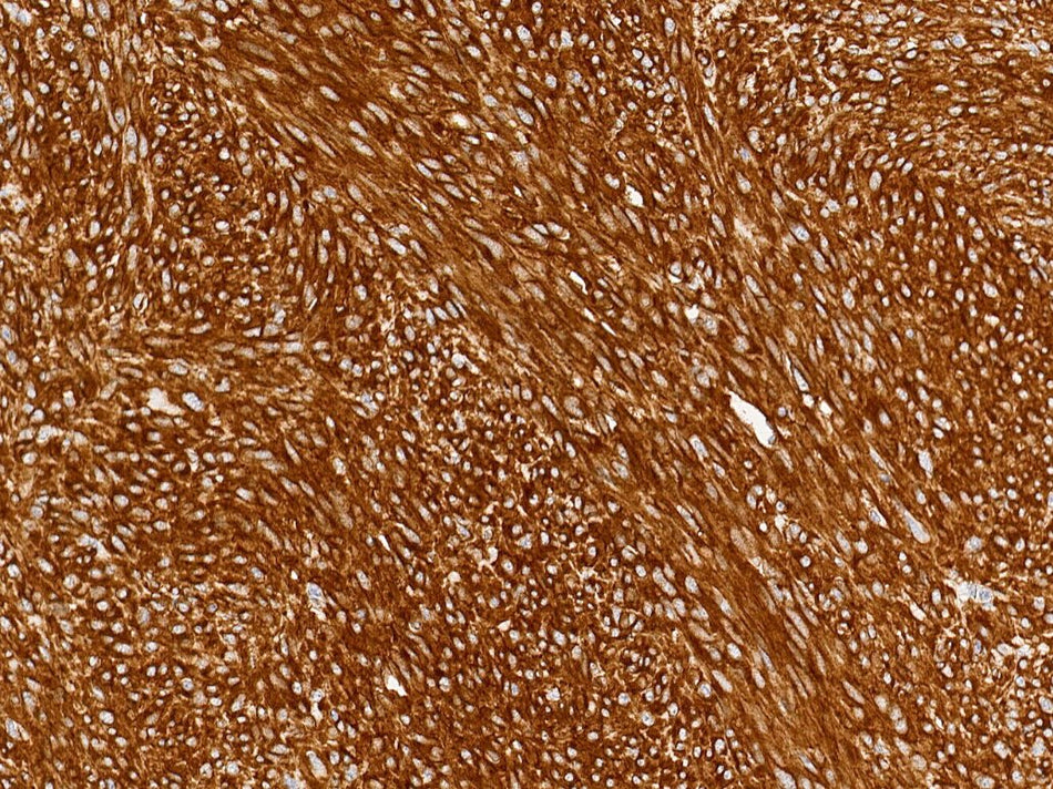 Marquage immunohistochimique anti-c-KIT/CD117 — Dartmon