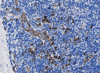Marquage immunohistochimique anti-CD123 — Dartmon