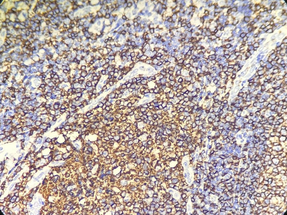 Marquage immunohistochimique anti-CD20 — Dartmon