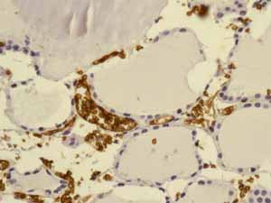 Marquage immunohistochimique anti-Glycophorine A — Dartmon