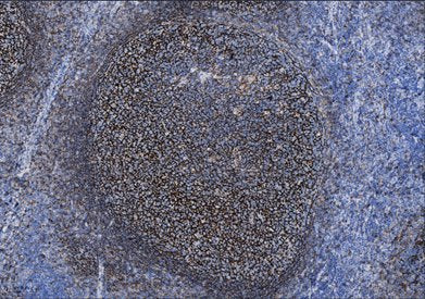 Marquage immunohistochimique anti-CD35 — Dartmon