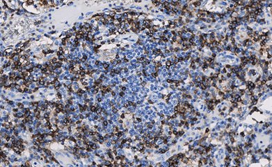 Marquage immunohistochimique anti-CD45RO — Dartmon