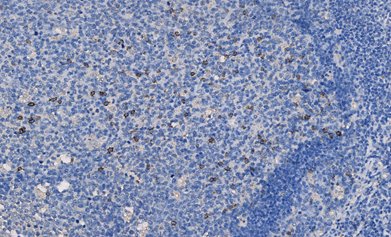 Marquage immunohistochimique anti-CD57 — Dartmon