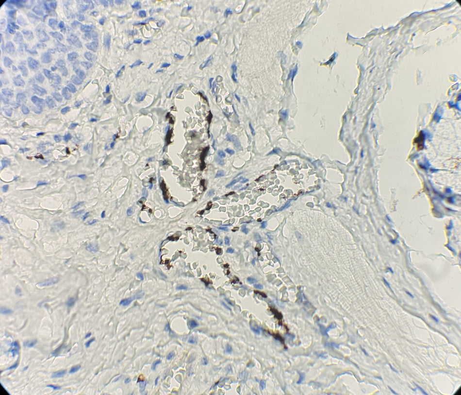 Marquage immunohistochimique anti-CD61 — Dartmon