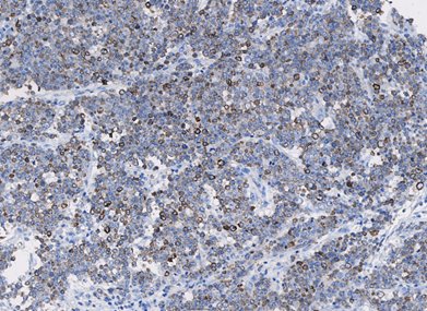 Marquage immunohistochimique anti-COX-2 — Dartmon