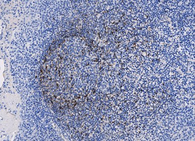 Marquage immunohistochimique anti-CXCL-13 — Dartmon