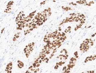 Marquage immunohistochimique anti-RE — Dartmon