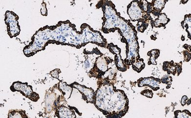 Marquage immunohistochimique anti-hPL — Dartmon