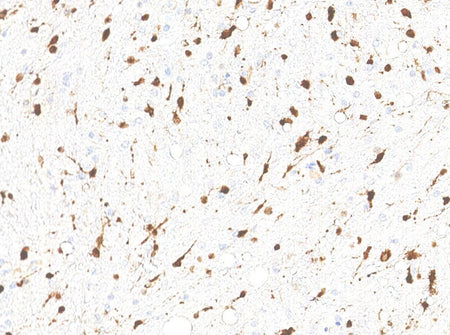 Marquage immunohistochimique anti-IDH1 — Dartmon