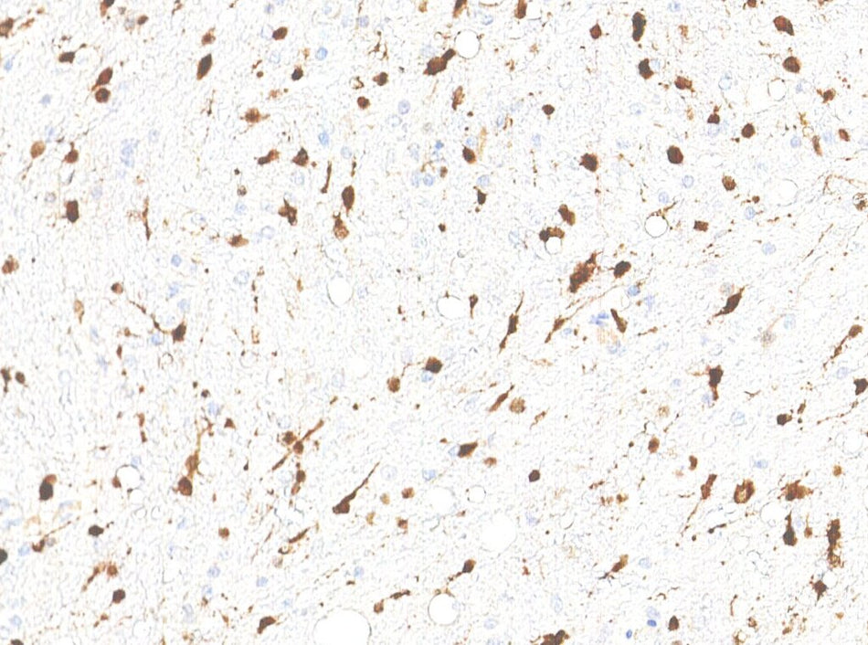 Marquage immunohistochimique anti-IDH1 — Dartmon