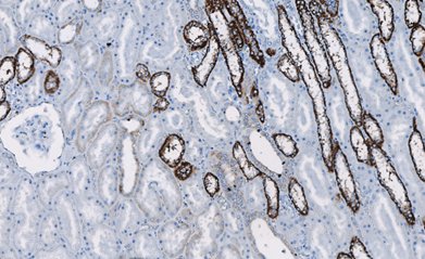 Marquage immunohistochimique anti-Ksp-Cadhérine — Dartmon