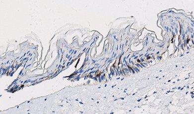 Marquage immunohistochimique anti-Langerine — Dartmon