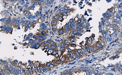 Marquage immunohistochimique anti-LRP — Dartmon